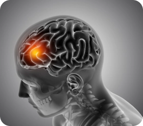 Avaliação de cistos e tumores cerebrais